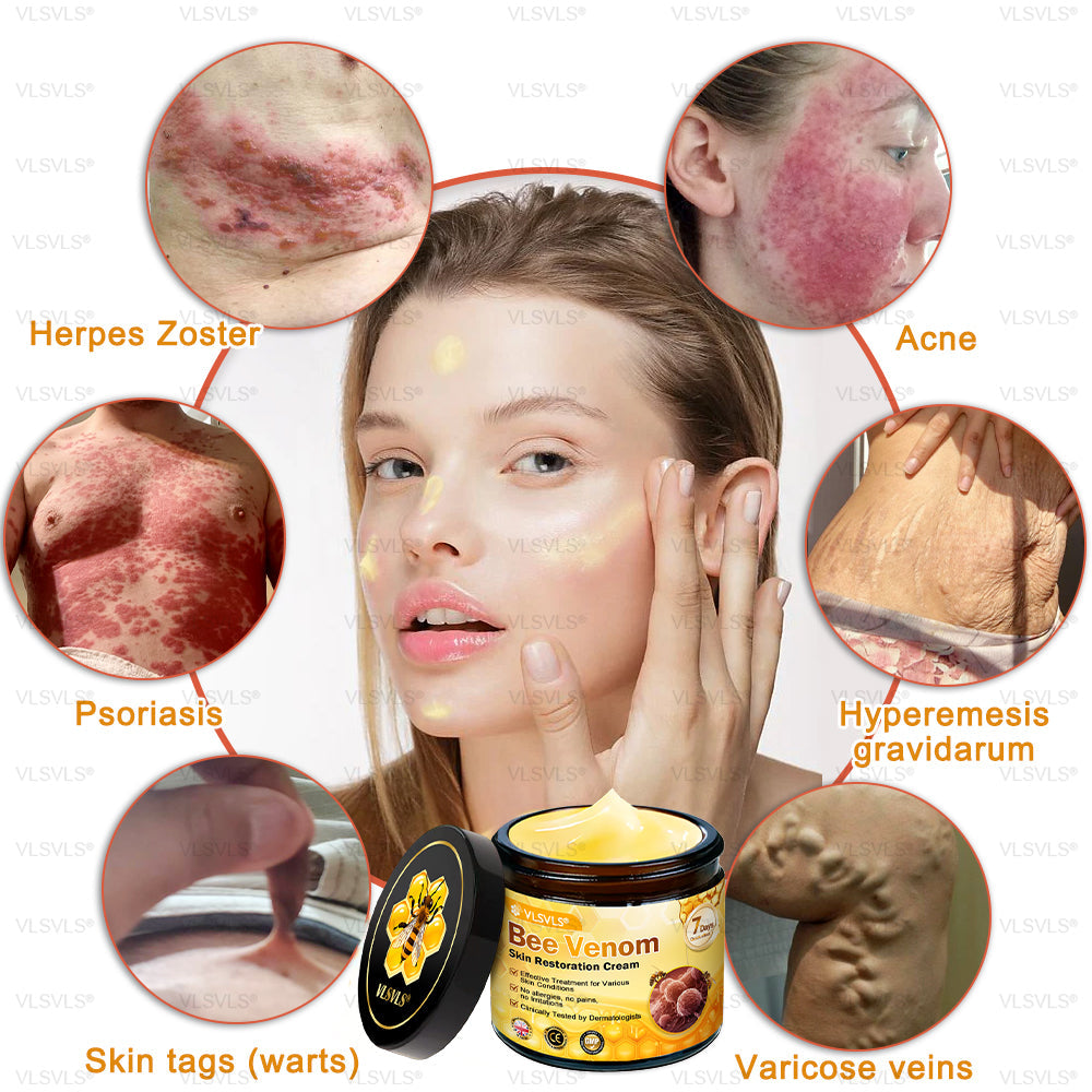 💐🌟💐Made and Shipped from UK ✨ VLSVLS® Bee Venom Skin Restoration Cream 🔥 LAST DAY 80% OFF