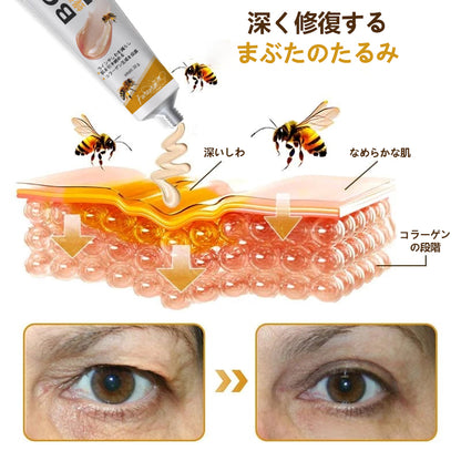 💎🐝 Furzero™ ボトックス＆ビーベノム しわ取りリフトアップクリーム✨🔥 最終日限定プロモーション – 70%OFF ✨🔥