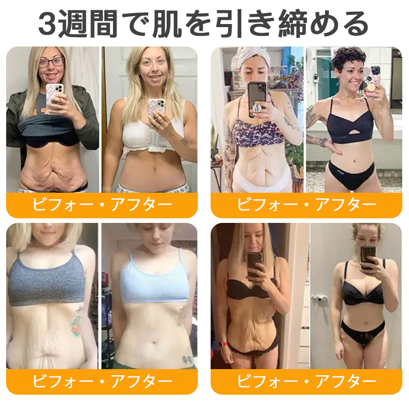 🌿 TLOPA® 蜂毒スキンリペアクリーム 🔥【最終日】本日限定 80%オフ！🌟
