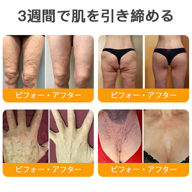 🌿 TLOPA® 蜂毒スキンリペアクリーム 🔥【最終日】本日限定 80%オフ！🌟