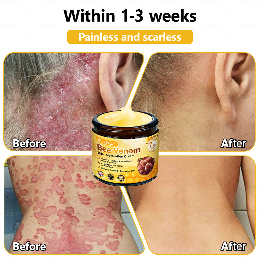 💐🌟💐Made and Shipped from UK ✨ VLSVLS® Bee Venom Skin Restoration Cream 🔥 LAST DAY 80% OFF