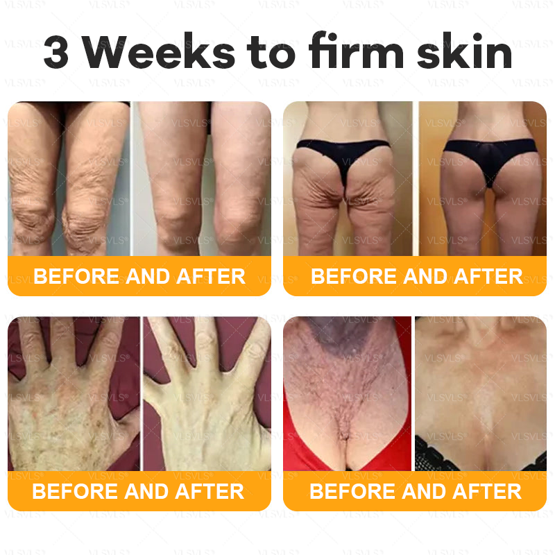 💐🌟💐Made and Shipped from UK ✨ VLSVLS® Bee Venom Skin Restoration Cream 🔥 LAST DAY 80% OFF