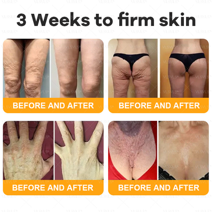 💐🌟💐Made and Shipped from UK ✨ VLSVLS® Bee Venom Skin Restoration Cream 🔥 LAST DAY 80% OFF