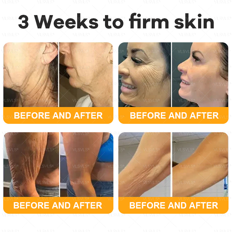💐🌟💐Made and Shipped from UK ✨ VLSVLS® Bee Venom Skin Restoration Cream 🔥 LAST DAY 80% OFF