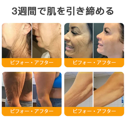🌿 TLOPA® 蜂毒スキンリペアクリーム 🔥【最終日】本日限定 80%オフ！🌟