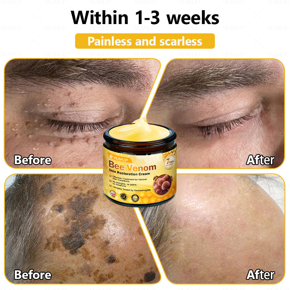 💐🌟💐Made and Shipped from UK ✨ VLSVLS® Bee Venom Skin Restoration Cream 🔥 LAST DAY 80% OFF