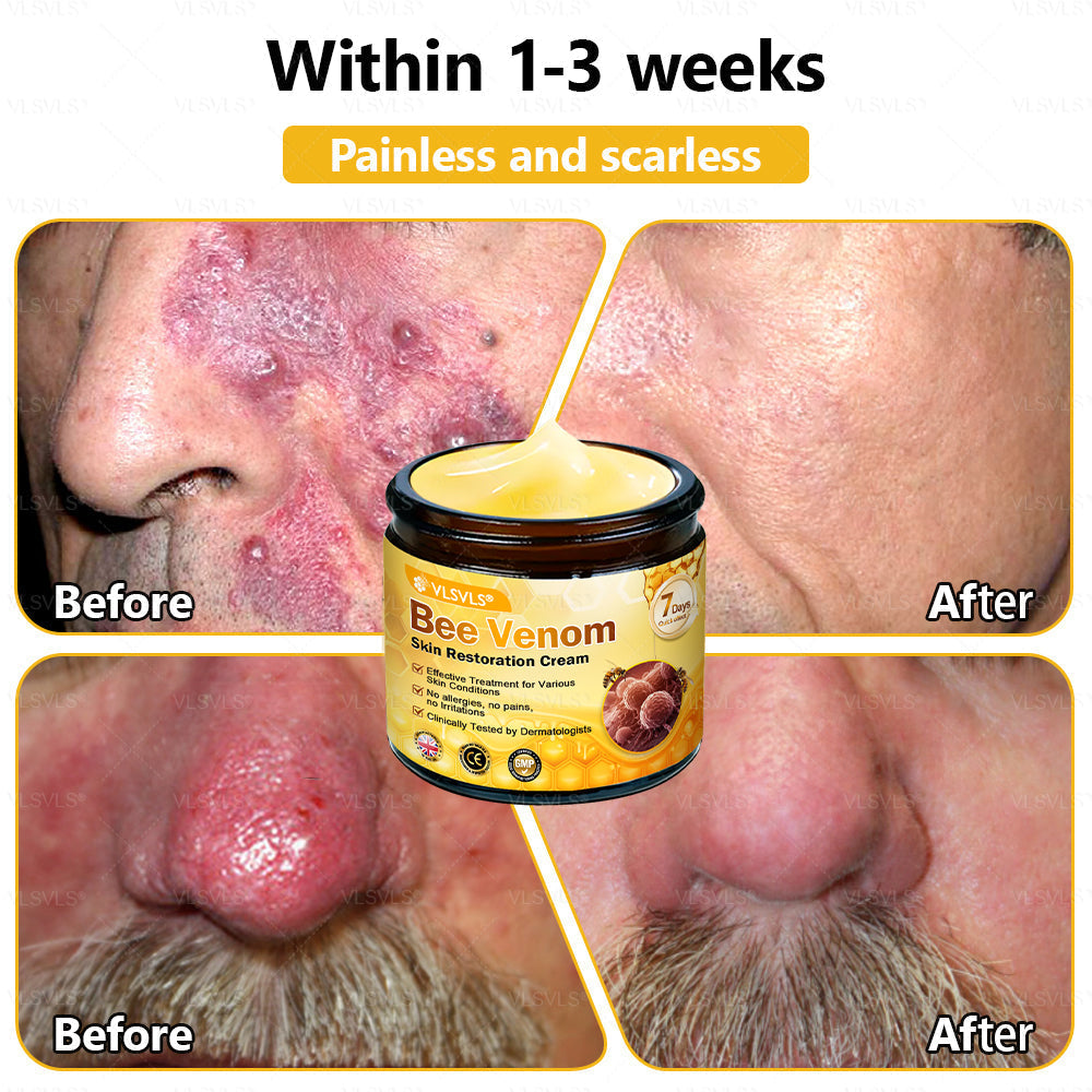 💐🌟💐Made and Shipped from UK ✨ VLSVLS® Bee Venom Skin Restoration Cream 🔥 LAST DAY 80% OFF