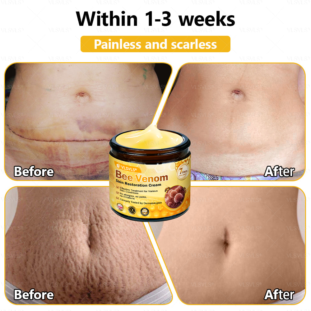 💐🌟💐Made and Shipped from UK ✨ VLSVLS® Bee Venom Skin Restoration Cream 🔥 LAST DAY 80% OFF