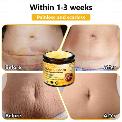 💐🌟💐Made and Shipped from UK ✨ VLSVLS® Bee Venom Skin Restoration Cream 🔥 LAST DAY 80% OFF